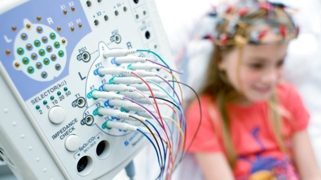 Çocuklarda nadir görülen epilepsi türlerinde yapay zeka ile erken tanı görseli